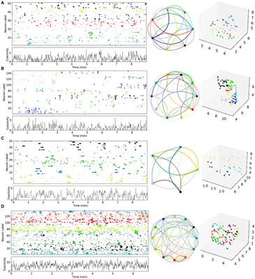 Pathological cell assembly dynamics in a striatal MSN network model